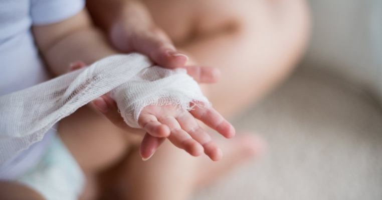 Medic din Cluj cercetat pentru malpraxis după ce a pus greșit în ghips mâna unui copil