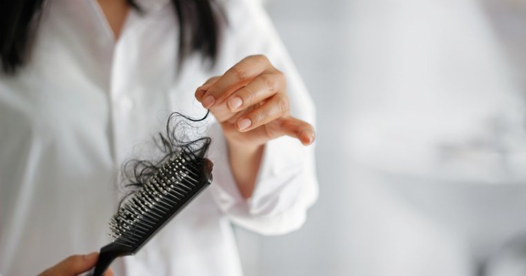 Alopecia postpartum: de ce apare și cum o tratăm corect