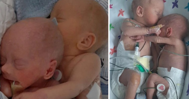 Imaginea care a înduioșat internetul. Doi bebeluși gemeni născuți prematur se îmbrățișează când sunt puși în același incubator