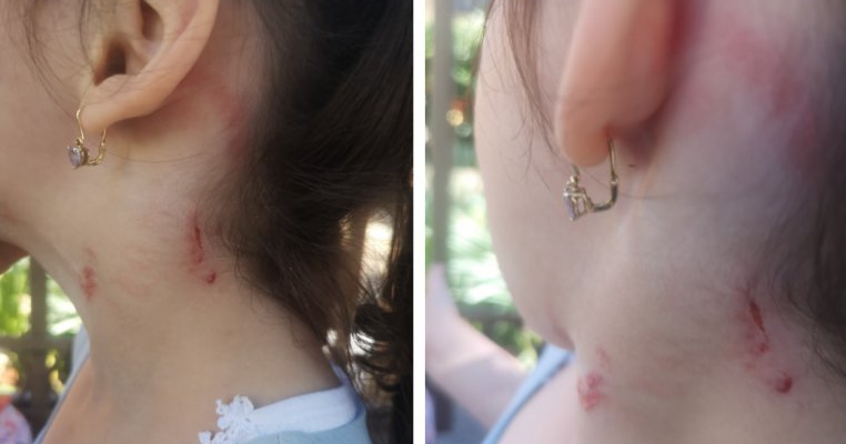 Caz șocant la o grădiniță din București. O fetiță de trei ani a fost agresată de educatoare