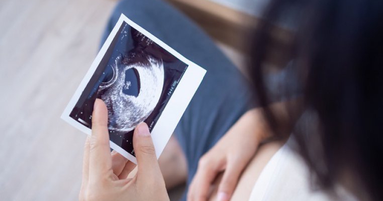 Cum ai grijă de bebe în primul trimestru de sarcină