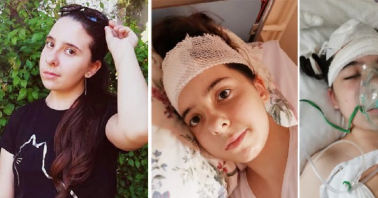 Ariana se luptă de la 11 luni pentru viața ei: a făcut pareză de la varicelă iar acum, la 14 ani, se luptă și cu 2 tumori cerebrale. Cum poți să o ajuți să aibă o viață normală