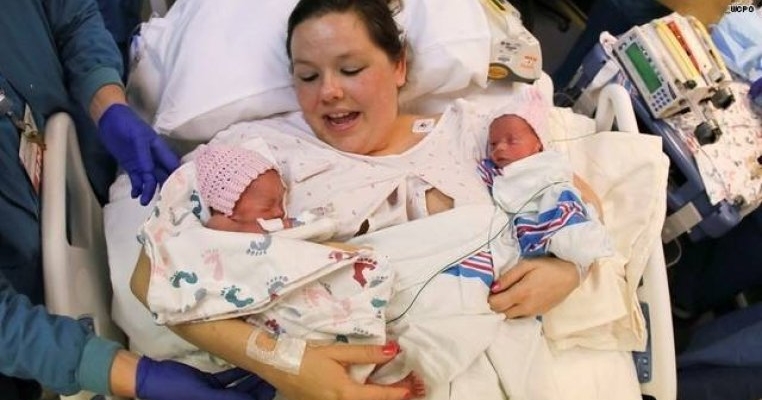 Gemene inseparabile: s-au născut ținându-se de mână