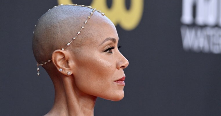 Alopecie la femei? Cum se manifestă boala de care suferă soția lui Will Smith