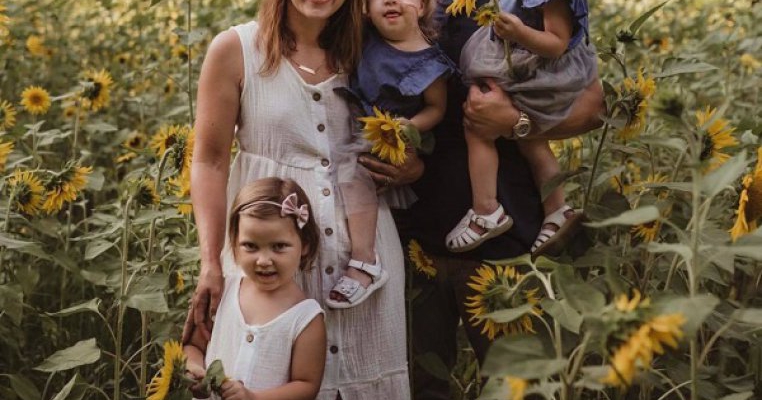 O minune! Cum se simt gemenele siameze din Michigan după ce au fost separate