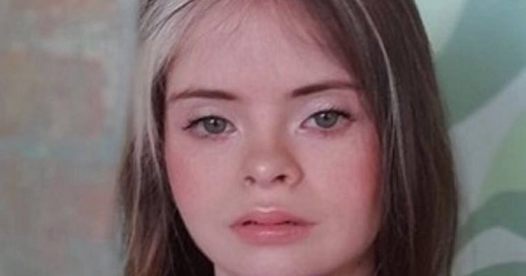 Ce este frumusețea? Jessica, un model cu sindromul Down, îți dă răspunsul
