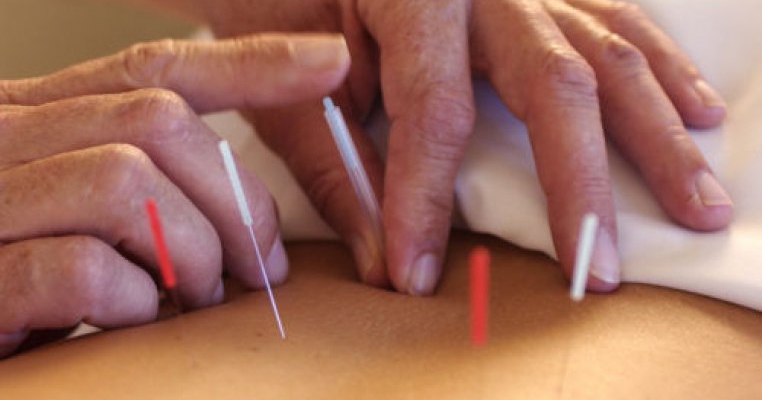 Fibromul uterin: tratament naturist