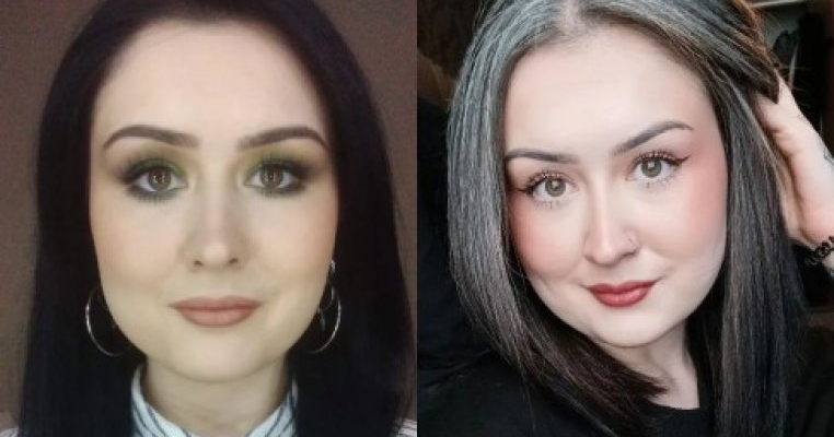 Are păr alb la numai 16 ani. Cu toate astea, se simte mai bine ca niciodată!
