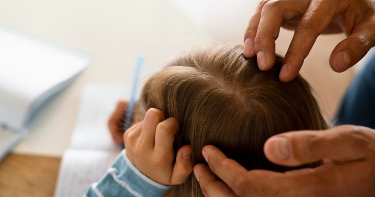 O fetiță de 8 ani cu alopecie este dovada clară de curaj! Și-a pierdut părul, dar și-a păstrat încrederea în ea