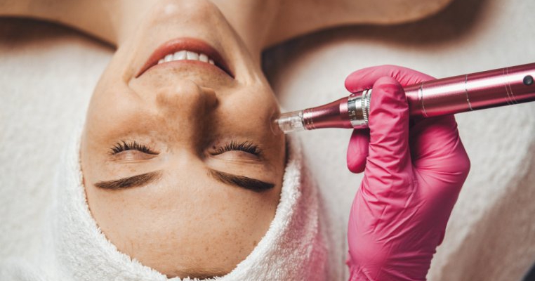 Microdermabraziunea facială: ce este și cum te ajută să ai o piele frumoasă?