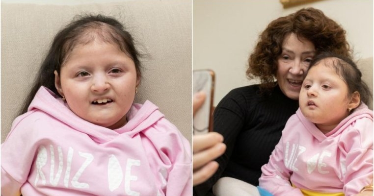 Este o tânără de 19 ani, dar arată ca o fetiță de 4 ani. Ce diagnostic a primit și cât de rară este afecțiunea ei