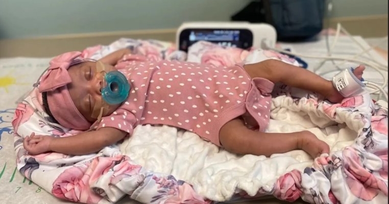 Premieră medicală! Prima operație pe creier reușită la un bebeluș aflat încă în pântecul mamei