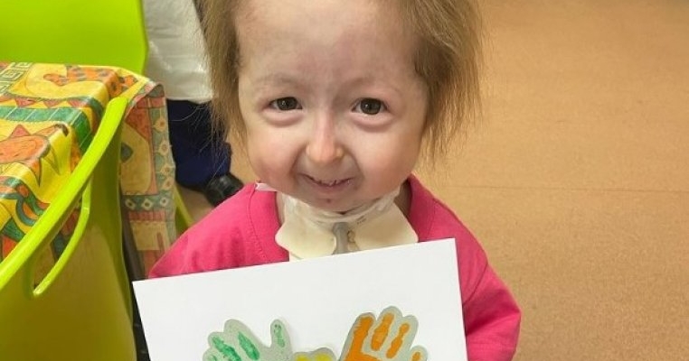 Fetița cu cea mai rară boală din lume! Medicii nu i-au putut da un diagnostic