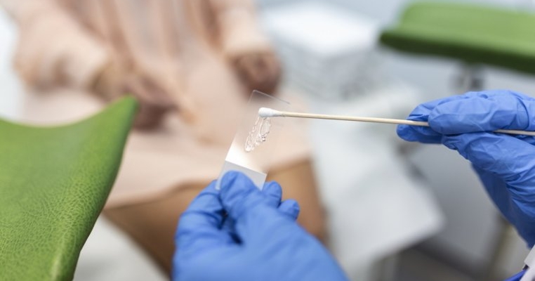 Celule endocervicale prezente: ce înseamnă dacă apar în rezultatele Papanicolau?