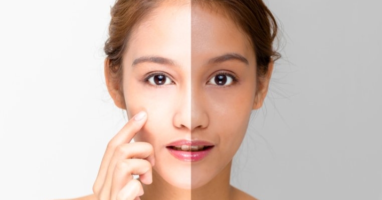 Asimetria facială: ce este și cum o poți rezolva