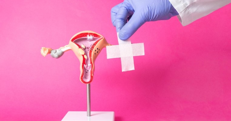 Totul despre histeroscopia diagnostică și intervențională