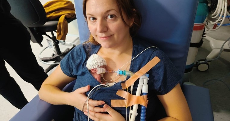 Unul dintre cei mai mici bebeluși prematuri din lume s-a născut la 328 de grame. Este extrem de mică, dar luptă să trăiască