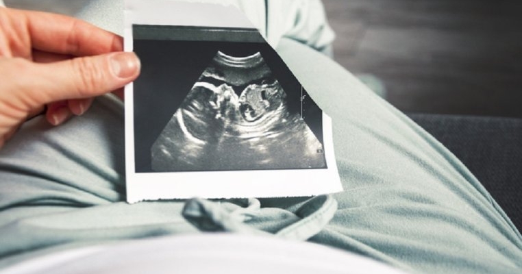 Cât costă fertilizarea in vitro în România