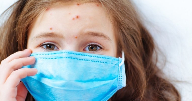 Este oficial! A fost declarată epidemie de rujeolă în România