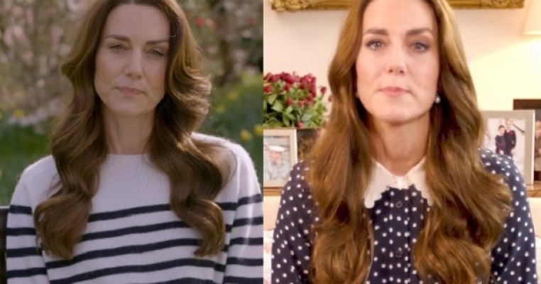 Ce este chimioterapia preventivă, tratamentul pe care îl urmează în prezent Kate Middleton