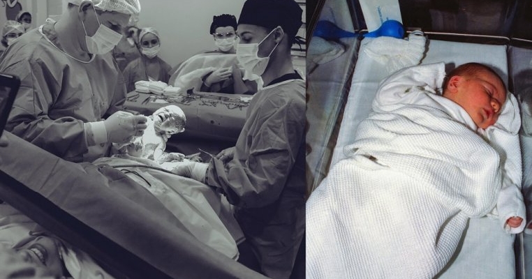 Am vrut să nasc normal dar nu am putut. Medicul a încercat să scoată copilul cu forcepsul și când a văzut ca nu reușește, i-a împins căpșorul înapoi și m-a operat de urgență