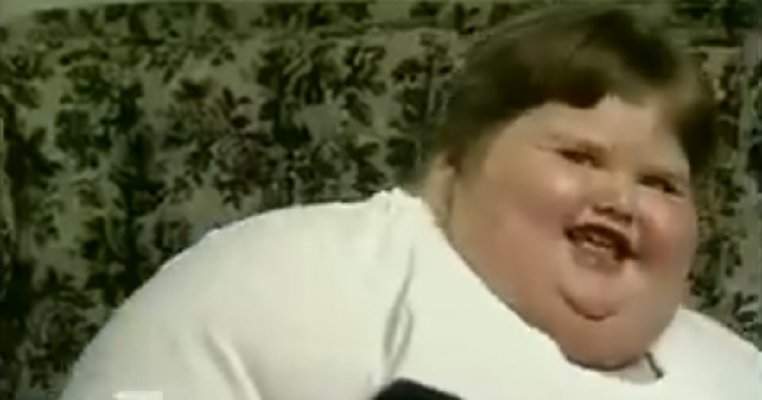 „Am fost cel mai gras copil din lume. Aveam 200 de kg și mâncam 10000 de calorii pe zi. Acum sunt de nerecunoscut"