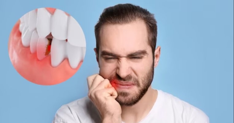 Sfaturi pentru prevenirea cariilor la copii și adulți