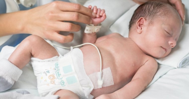 Pampers continuă să fie alături de micii luptători prin donația de scutece Pampers special concepute pentru prematuri