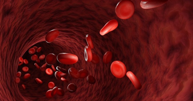 Anemia falciforma: cauze, simptome si tratament