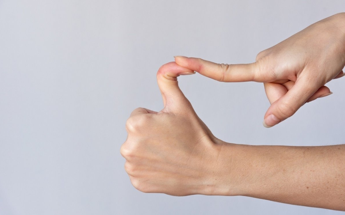 Sindromul Ehlers-Danlos: cauze, simptome și tratament