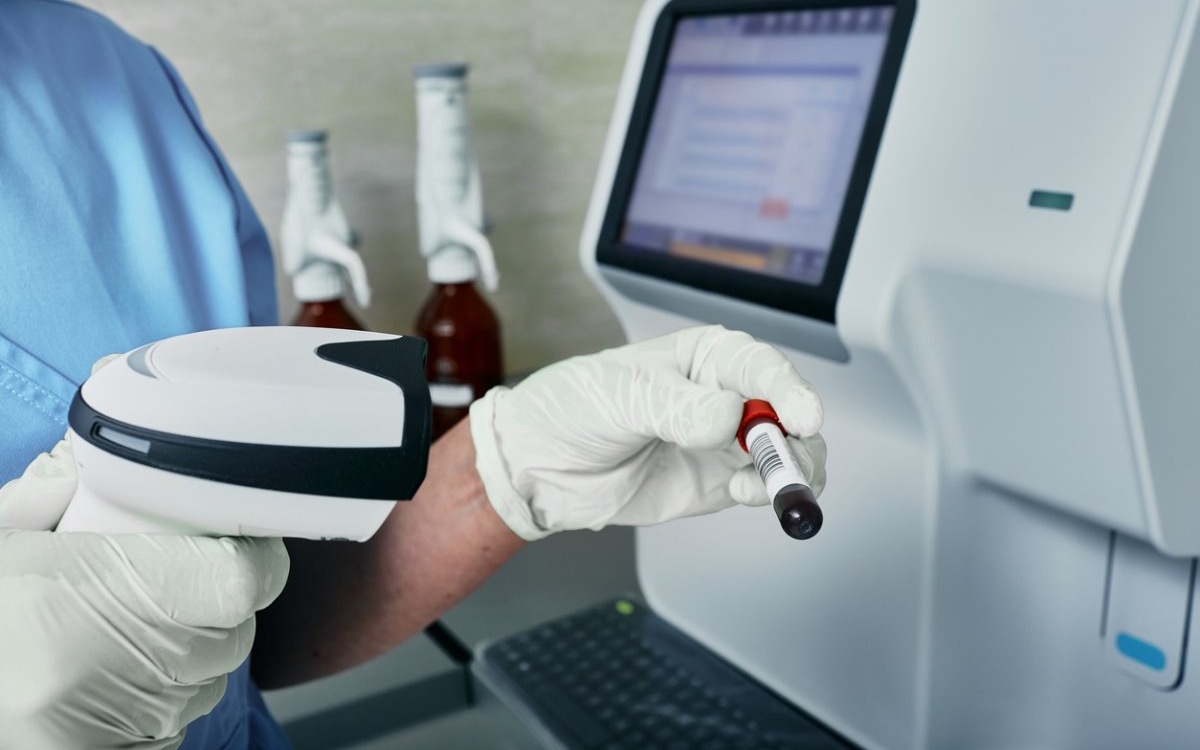 Calprotectina: ce este și când este recomandată?