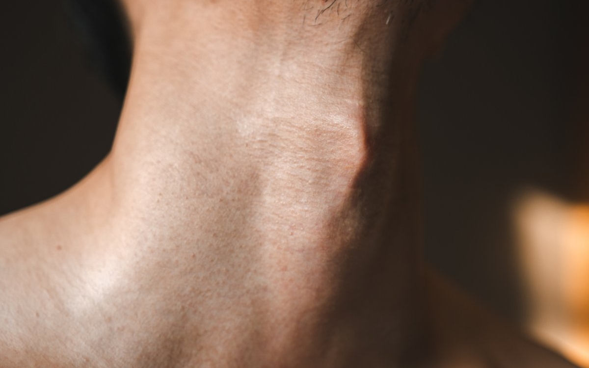 Semnul Kussmaul: cauze, simptome și tratament