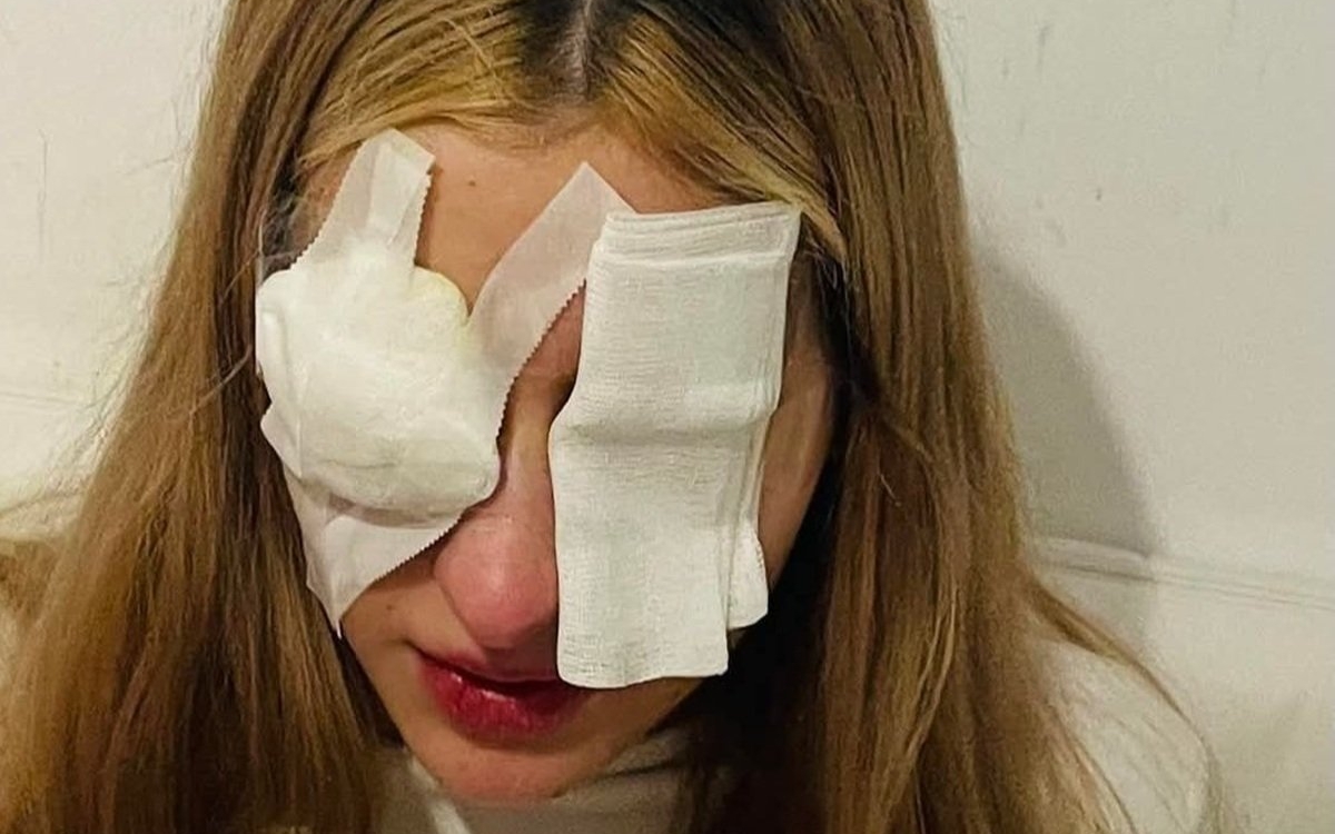 O mamă trage un semnal de alarmă pentru părinții de fete adolescente după ce fiica ei a ajuns cu corneea arsă. „Aruncați toate cutiile cu gene false"