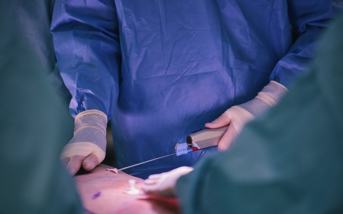 Terapia cu țesut adipos microfragmentat: ce este și cum acționează?