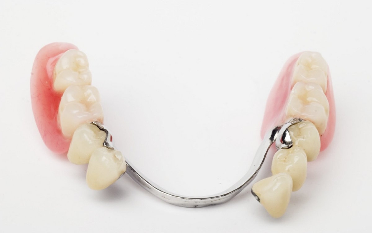 Cum sa alegi bontul protetic potrivit pentru fiecare caz? X sfaturi si recomandari