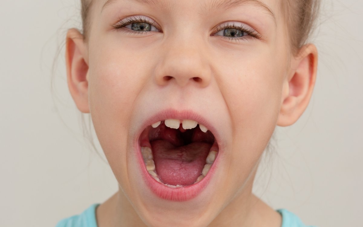 Streptococcus salivarius: beneficii și recomandări