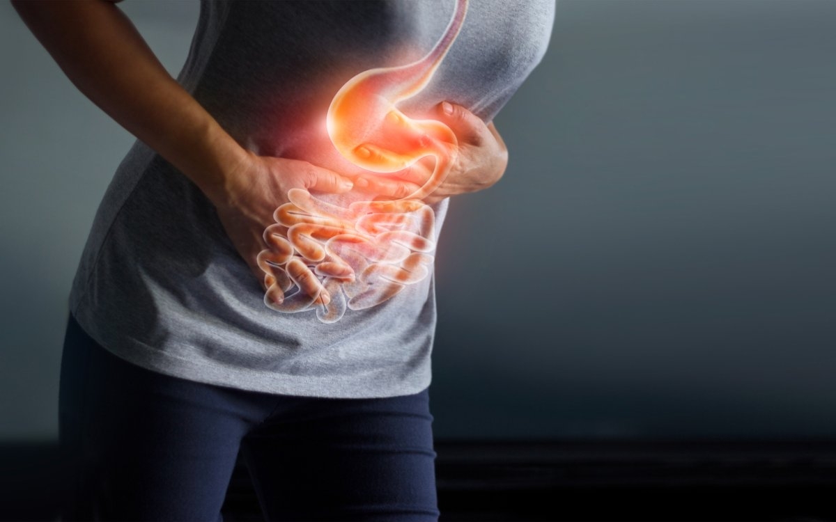 Diverticulul Meckel: cauze, simptome și tratament