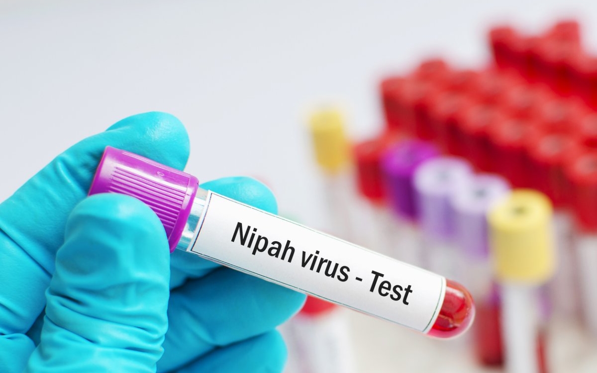 Virusul Nipah: cauze, simptome și tratament
