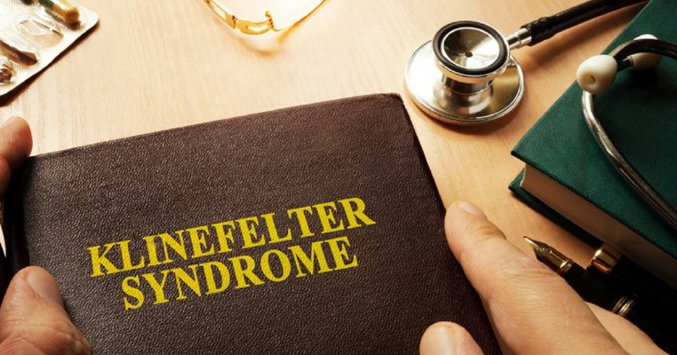 Sindromul Klinefelter: informații complete