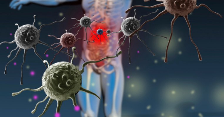 Sindromul Sjogren: informatii complete