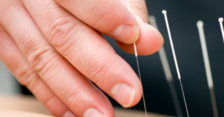 Sustinere pentru tratament prin acupunctura