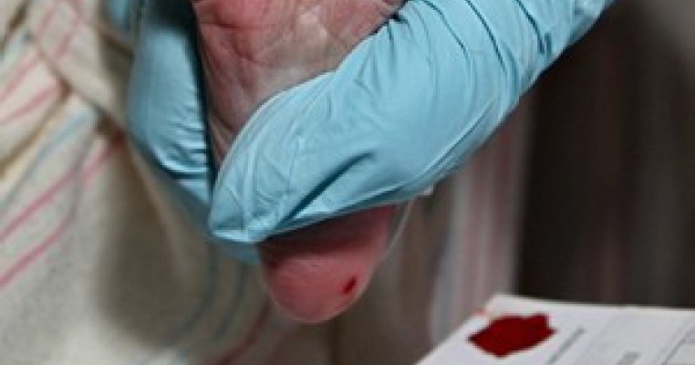 Totul despre testul de sange din calcaiul bebelusului