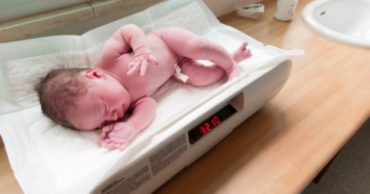 scaderea in greutate a nou-nascutului)