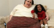 Gravidă de 240 kilograme