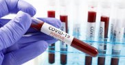 A fost confirmat și cu Covid-19