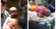 Un bebeluș de 6,3 kg s-a născut prin cezariană