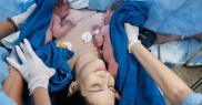 Laptele de sân conține două tipuri de proteine: caseină și zer!