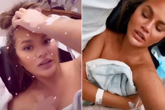 Chrissy Teigen a făcut transfuzii, după ce a sângerat timp de o lună