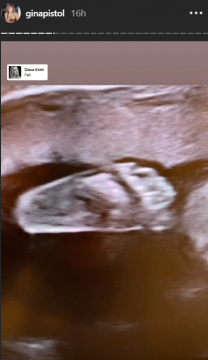 Gina Pistol a arătat ecografia bebelușului ei