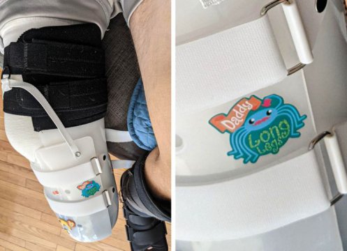 „Tocmai mi-am pierdut piciorul în urma unui accident de motocicletă. Acesta este sticker-ul pe care fiul meu l-a ales pentru a-mi decora orteza”